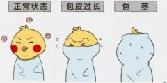 包皮过长会引起包皮炎吗