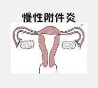 附件炎的症状是什么？